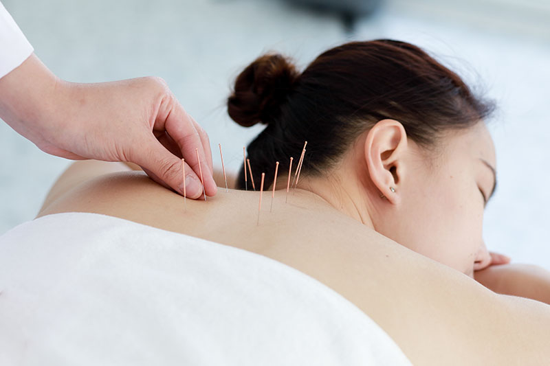 Acupuncture Massage